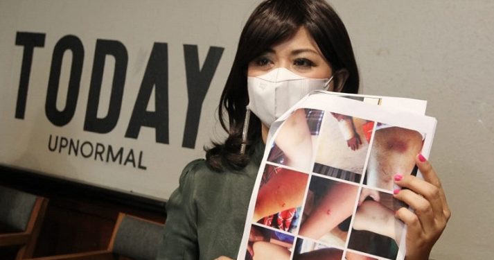 Yuyun Sukawati Jadi Korban KDRT Oleh Suaminya