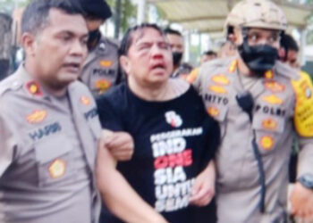 Dikeroyok Dalam Aksi Demo di DPR, Begini Kondisi Ade Armando